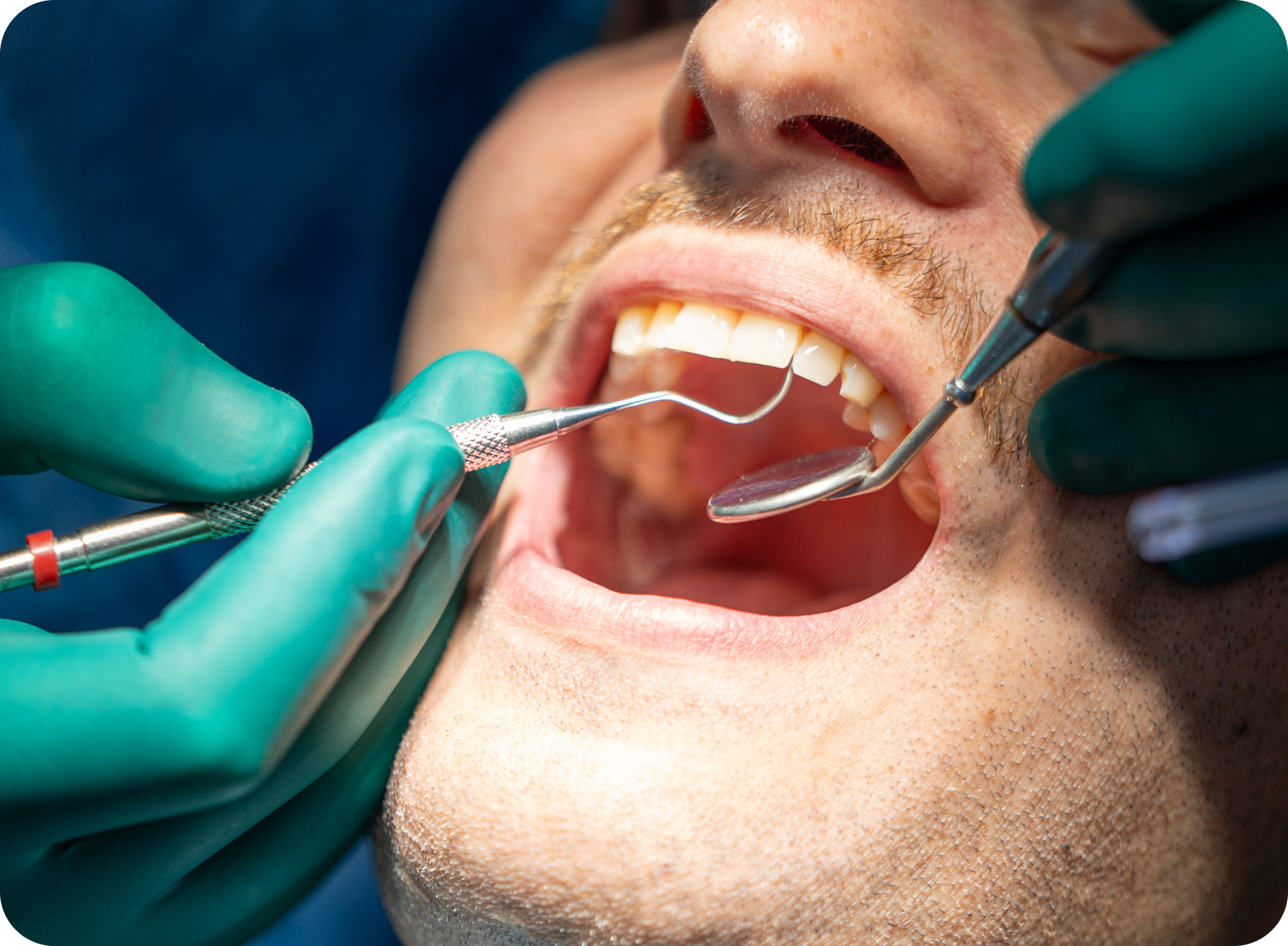 Dentisterie esthétique