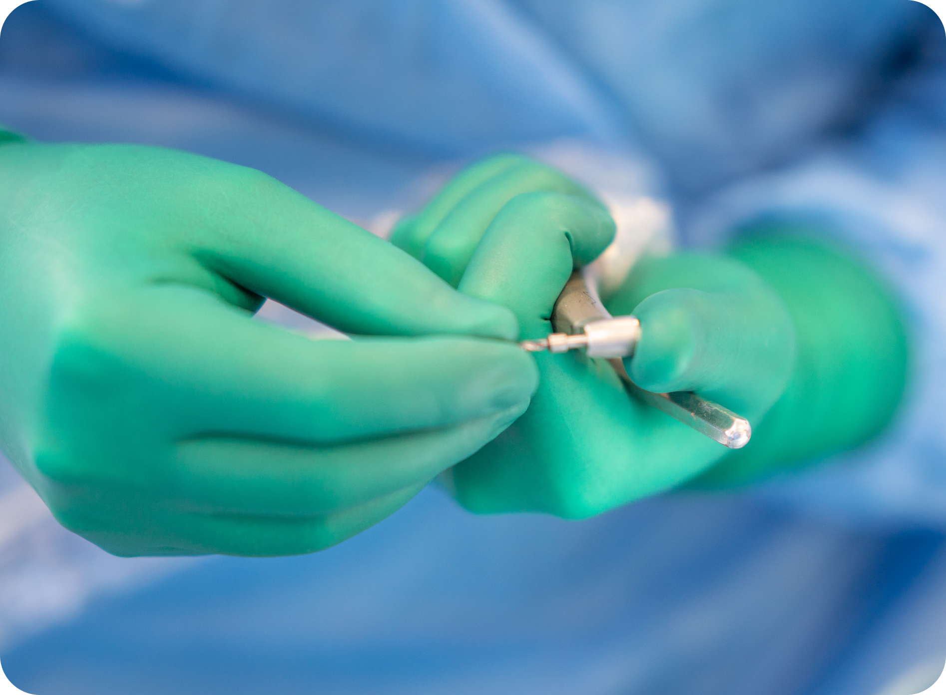 Extraction des dents de sagesse